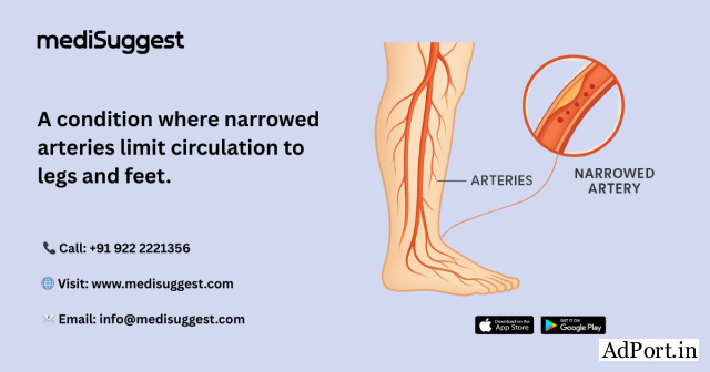 peripheral vascular intervention hitec city