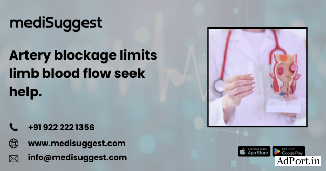 Advanced PVD management and diagnosis in banjara hills