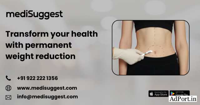 Best bariatric surgery in banjara hills