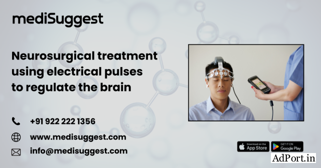 Neurologist for DBS Banjara Hills