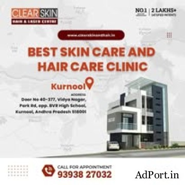 facial port wine stain Treatment in india