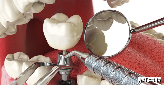 Affordable Dental Clinic in Delhi for Complete Oral Care