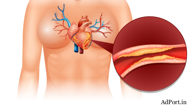 CT Coronary Angiography Pricing Explained with Benefits Overview