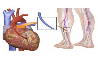 Best Cardiac Surgeon in Bangalore | Robotic Heart Surgery
