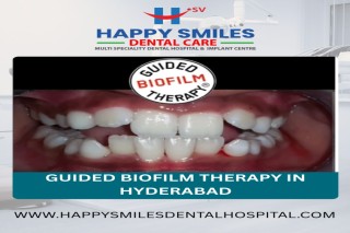 Affordable Guided Biofilm Therapy Cost in Hyderabad 