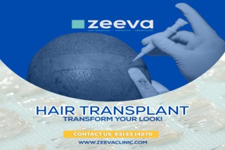 Advanced Solutions for Hair Loss at the Premier Hair Clinic Ahmedabad