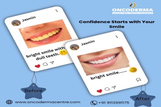Best Dental Clinic in Rajanukunte, Sahakarnagar and Singanayakanahalli OncoDerma Centre