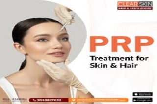 Best Birthmark removal laser treatment in india