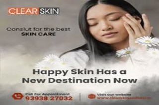  Advanced Xanthelasma Treatment in india Clear Skin Kurnool