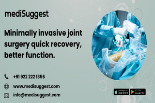 arthroscopy in banjara hills