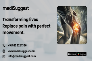 joint replacement treatment options banjara hills