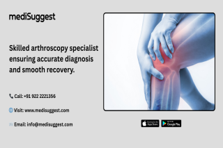 arthroscopy specialist in hitec city