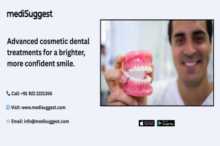 dental implants hitec city