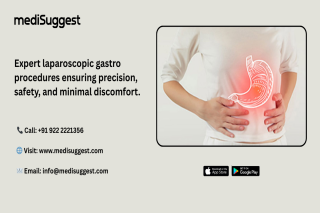laparoscopic gastro surgery in hitec city