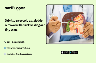 Laparoscopic gallbladder surgery hitec city