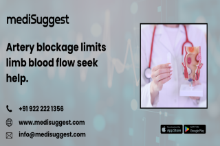 Advanced PVD management and diagnosis in banjara hills