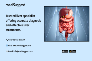 Top Liver Care Specialists In Hitec City