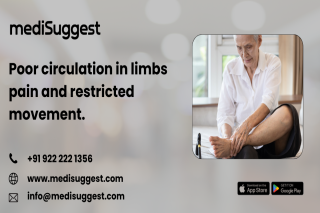 Experienced vascular specialist for pvd in banjara hills