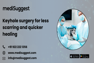 Laparoscopic surgery center banjara hills