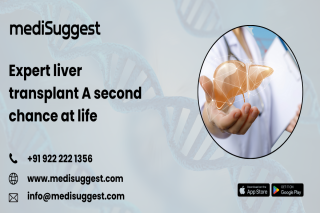 Liver Failure Treatment Banjara Hills