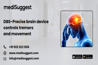Deep brain stimulation banjara hills