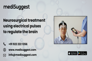 Neurologist for DBS Banjara Hills