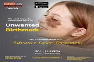 PRP hair Treatment in india Clear Skin in Kurnool