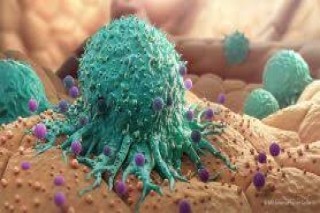Immunotherapy Cancer Treatment in Delhi NCR
