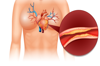 CT Coronary Angiography Pricing Explained with Benefits Overview